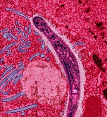 Plasmodium (malaria pathogen_ in the midgut of a mosquito. 